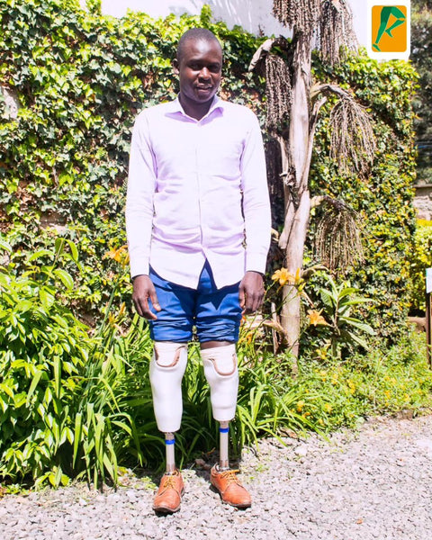 Donate to Prothea Kenya & Help Provide Affordable Prosthetics for Kenyan Amputees